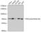 DNA Polymerase Eta antibody, GTX54545, GeneTex, Western Blot image 