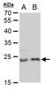 Lin-7 Homolog A, Crumbs Cell Polarity Complex Component antibody, GTX631107, GeneTex, Western Blot image 