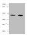 Tetratricopeptide Repeat Domain 1 antibody, A52684-100, Epigentek, Western Blot image 