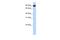 Transmembrane And Tetratricopeptide Repeat Containing 4 antibody, A16097, Boster Biological Technology, Western Blot image 