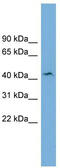 Beta-1,4-Galactosyltransferase 3 antibody, TA338207, Origene, Western Blot image 