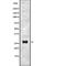 Transmembrane Protein 106C antibody, GTX03354, GeneTex, Western Blot image 