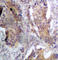 Phosphatase And Tensin Homolog antibody, AP0435, ABclonal Technology, Immunohistochemistry paraffin image 