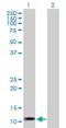 LOC541473 antibody, H00541473-B01P-50ug, Novus Biologicals, Western Blot image 