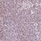 Ribosome Biogenesis Regulator 1 Homolog antibody, PA5-63912, Invitrogen Antibodies, Immunohistochemistry frozen image 