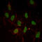 Estrogen Receptor 1 antibody, abx015850, Abbexa, Enzyme Linked Immunosorbent Assay image 