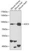 Amine Oxidase Copper Containing 3 antibody, A02851, Boster Biological Technology, Western Blot image 