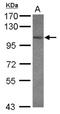 Glutamate Ionotropic Receptor Kainate Type Subunit 3 antibody, NBP2-16681, Novus Biologicals, Western Blot image 