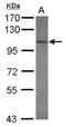 Glutamate receptor, ionotropic kainate 3 antibody, NBP2-16681, Novus Biologicals, Western Blot image 