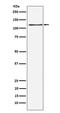 Kinase Suppressor Of Ras 1 antibody, M03285, Boster Biological Technology, Western Blot image 