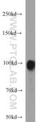 Ectonucleotide Pyrophosphatase/Phosphodiesterase 2 antibody, 14243-1-AP, Proteintech Group, Western Blot image 