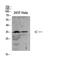 Suppressor of cytokine signaling 2 antibody, A01584-1, Boster Biological Technology, Western Blot image 