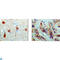 Pro-Apoptotic WT1 Regulator antibody, LS-C812826, Lifespan Biosciences, Western Blot image 