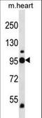 Glycogen Phosphorylase B antibody, LS-C162339, Lifespan Biosciences, Western Blot image 
