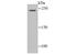 Sodium Voltage-Gated Channel Alpha Subunit 10 antibody, NBP2-75584, Novus Biologicals, Western Blot image 