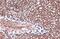 Fatty Acid Binding Protein 4 antibody, NBP1-33616, Novus Biologicals, Immunohistochemistry paraffin image 