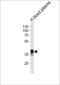 Serpin Family A Member 7 antibody, 62-421, ProSci, Western Blot image 