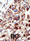 Signal Transducing Adaptor Molecule antibody, abx031569, Abbexa, Immunohistochemistry paraffin image 