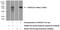 Kazal Type Serine Peptidase Inhibitor Domain 1 antibody, 20815-1-AP, Proteintech Group, Western Blot image 