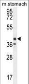 Tectorin Beta antibody, LS-C161795, Lifespan Biosciences, Western Blot image 