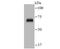 Zeta Chain Of T Cell Receptor Associated Protein Kinase 70 antibody, A00754-1, Boster Biological Technology, Western Blot image 