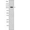 EPH Receptor B1 antibody, PA5-64637, Invitrogen Antibodies, Western Blot image 