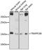 Trafficking Protein Particle Complex 6B antibody, LS-C750529, Lifespan Biosciences, Western Blot image 