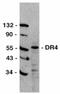 Tumor necrosis factor receptor superfamily member 10A antibody, AHP439, Bio-Rad (formerly AbD Serotec) , Western Blot image 