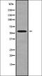 Tigger Transposable Element Derived 4 antibody, orb338756, Biorbyt, Western Blot image 