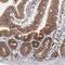 BAI1 Associated Protein 2 Like 2 antibody, HPA003043, Atlas Antibodies, Immunohistochemistry paraffin image 