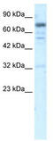 Ras And Rab Interactor 3 antibody, TA337253, Origene, Western Blot image 