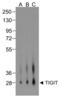 T Cell Immunoreceptor With Ig And ITIM Domains antibody, LS-C669099, Lifespan Biosciences, Western Blot image 