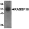 Ras Association Domain Family Member 10 antibody, PA5-21151, Invitrogen Antibodies, Western Blot image 