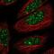 Thyroid Hormone Receptor Beta antibody, NBP2-57253, Novus Biologicals, Immunofluorescence image 