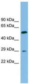 Transmembrane 4 L Six Family Member 20 antibody, TA338678, Origene, Western Blot image 