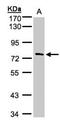 Tetratricopeptide Repeat Domain 30A antibody, NBP1-32574, Novus Biologicals, Western Blot image 