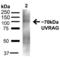 UV Radiation Resistance Associated antibody, LS-C775431, Lifespan Biosciences, Western Blot image 