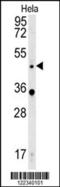 Wnt Family Member 5A antibody, MBS9210555, MyBioSource, Western Blot image 