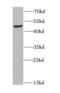 Histone Acetyltransferase 1 antibody, FNab03761, FineTest, Western Blot image 