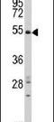 SMYD Family Member 5 antibody, PA5-13217, Invitrogen Antibodies, Western Blot image 