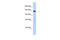 Splicing Factor 3b Subunit 3 antibody, 25-641, ProSci, Western Blot image 