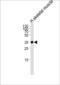 Interferon Gamma Receptor 2 antibody, LS-C165132, Lifespan Biosciences, Western Blot image 
