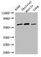 Acyloxyacyl Hydrolase antibody, LS-C498388, Lifespan Biosciences, Western Blot image 