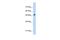 Patatin Like Phospholipase Domain Containing 3 antibody, PA5-43256, Invitrogen Antibodies, Western Blot image 