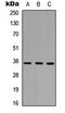 PIN2 (TERF1) Interacting Telomerase Inhibitor 1 antibody, LS-C356251, Lifespan Biosciences, Western Blot image 