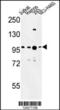 BAF Chromatin Remodeling Complex Subunit BCL11A antibody, 64-038, ProSci, Western Blot image 