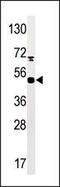 MAPK Activated Protein Kinase 5 antibody, PA5-12621, Invitrogen Antibodies, Western Blot image 