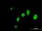 Interferon Gamma Inducible Protein 16 antibody, H00003428-B01P, Novus Biologicals, Immunofluorescence image 