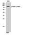 Ribosomal Protein S6 Kinase A1 antibody, STJ90474, St John