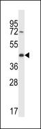 Cellular Repressor Of E1A Stimulated Genes 2 antibody, LS-C167031, Lifespan Biosciences, Western Blot image 